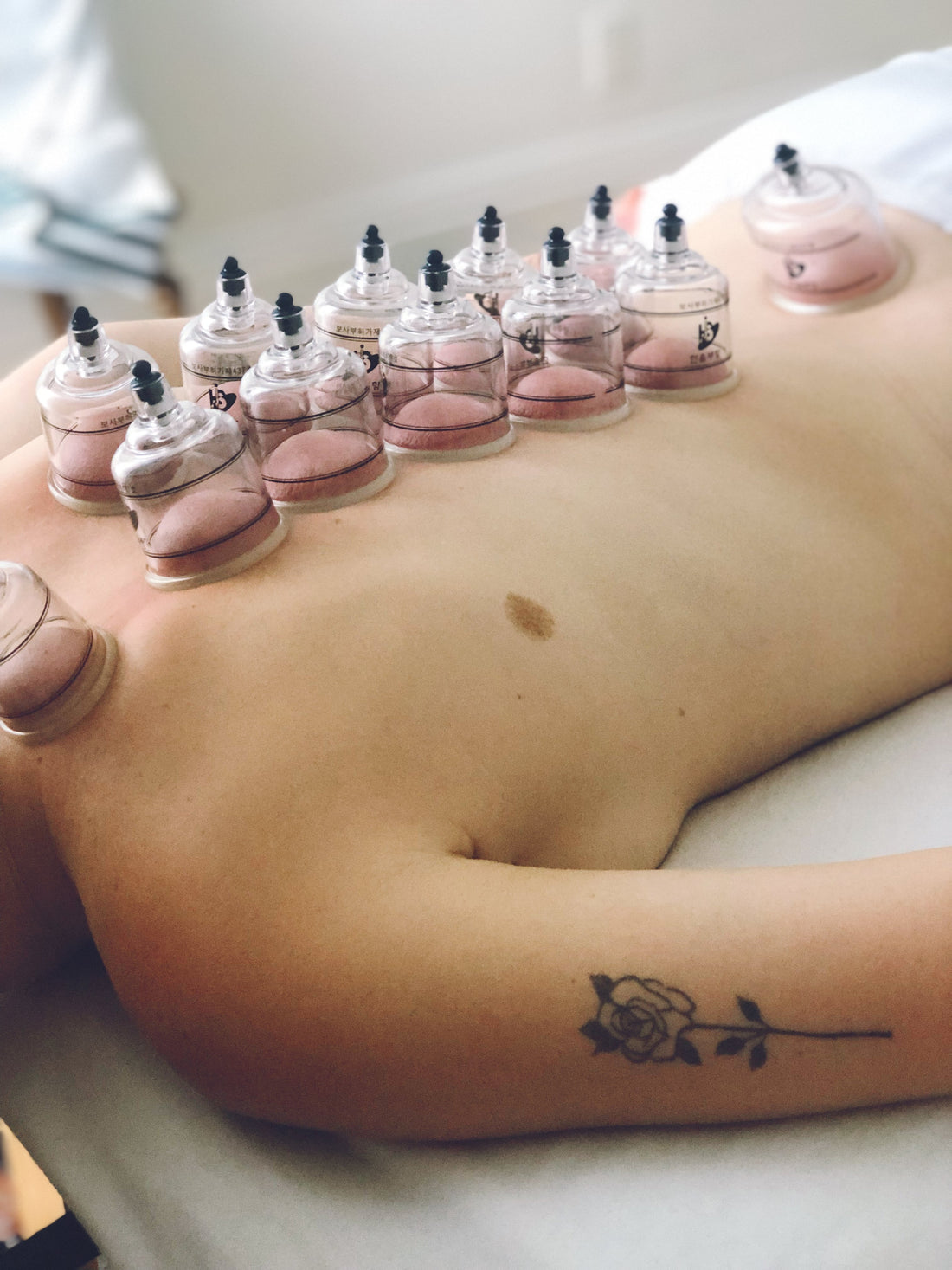 Qu’est-ce que le cupping?